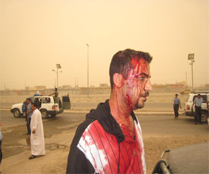 شرطة الفلوجة تعتدي بالضرب على مصور صحفي